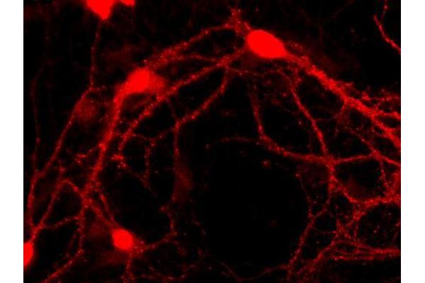 Regulating Synaptic Membrane Exocytosis 1 (RIMS1) (AA 207-366) antibody