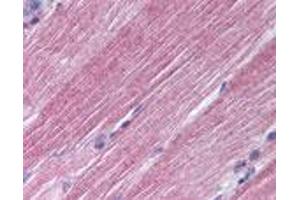 Rab-7 Immunohistochemistry. (RAB7A antibody)