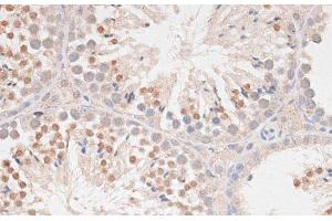 Immunohistochemistry of paraffin-embedded Mouse testis using MAD2L1 Polyclonal Antibody at dilution of 1:100 (40x lens). (MAD2L1 antibody)