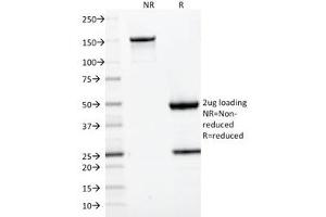SDS-PAGE analysis of purified, BSA-free CD22 antibody (clone BLCAM/1795) as confirmation of integrity and purity. (CD22 antibody  (AA 52-178))