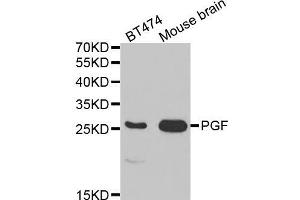 Western blot analysis of extracts of various cell lines, using PGF antibody (ABIN5970864) at 1/1000 dilution. (PLGF antibody)