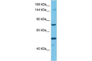 Host:  Rabbit  Target Name:  TMEM2  Sample Tissue:  Human HCT15 Whole Cell  Antibody Dilution:  1ug/ml