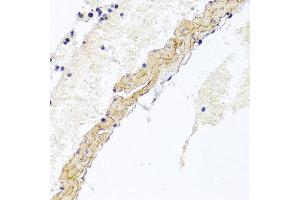 Immunohistochemistry of paraffin-embedded mouse lung using CD81 antibody at dilution of 1:100 (x40 lens). (CD81 antibody)