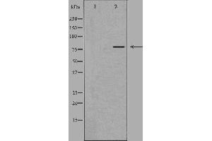 Western blot analysis of extracts from HUVEC cells, using NOL10 antibody.