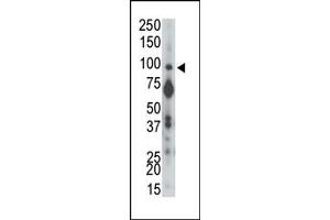 Western Blotting (WB) image for anti-Protein tyrosine Phosphatase, Receptor Type, A (PTPRA) (N-Term) antibody (ABIN360736) (PTPRA antibody  (N-Term))