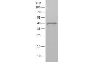 Parkin Protein (AA 1-165) (His-IF2DI Tag)