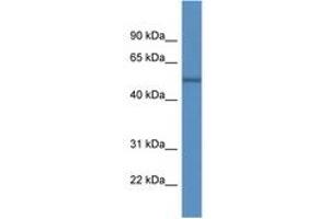 Image no. 1 for anti-rho GTPase Activating Protein 19 (ARHGAP19) (AA 395-444) antibody (ABIN6746897) (ARHGAP19 antibody  (AA 395-444))