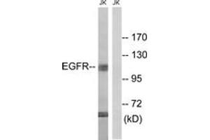Western blot analysis of extracts from Jurkat cells, treated with UV 15', using EGFR (Ab-998) Antibody. (EGFR antibody  (AA 966-1015))