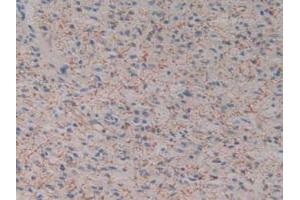 Figure. (Kallikrein 2 antibody  (AA 19-261))