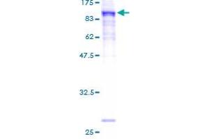 PRICKLE3 Protein (AA 1-615) (GST tag)