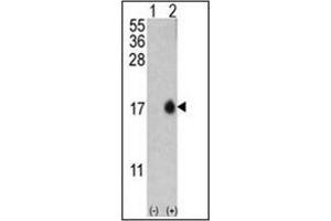 Western blot analysis of MAP1LC3B (arrow) using LC3B Antibody (T6) in Y79 cell line lysates and mouse brain tissue lysates (35 µg/lane). (LC3B antibody  (N-Term))