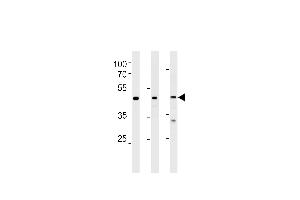 NROB1 Antibody (N-term) (ABIN389157 and ABIN2839323) western blot analysis in Hela,NCI-,PC-3 cell line lysates (35 μg/lane). (NR0B1 antibody  (N-Term))