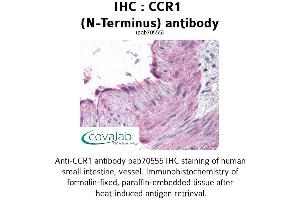 Image no. 1 for anti-Chemokine (C-C Motif) Receptor 1 (CCR1) (Extracellular Domain), (N-Term) antibody (ABIN1732754) (CCR1 antibody  (Extracellular Domain, N-Term))