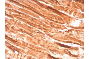 Formalin-fixed, paraffin-embedded human Skeletal Muscle stained with Dystrophin Monospecific Mouse Monoclonal Antibody (DMD/3242).