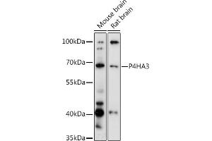 Western blot analysis of extracts of various cell lines, using P4H antibody (ABIN6132886, ABIN6145137, ABIN6145138 and ABIN6217878) at 1:3000 dilution. (P4HA3 antibody  (AA 20-110))
