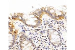Immunohistochemistry analysis of paraffin-embedded human colon using,CFA (ABIN7076044) at dilution of 1: 300 (TBCA antibody)