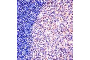 Immunohistochemistry analysis in formalin fixed and paraffin embedded human tonsil tissue reacted with MCM6 Antibody (N-term) followed which was peroxidase conjugated to the secondary antibody and followed by DAB staining. (MCM6 antibody  (N-Term))