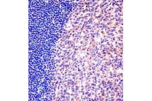 Immunohistochemistry analysis in formalin fixed and paraffin embedded human tonsil tissue reacted with MCM6 Antibody (N-term) followed which was peroxidase conjugated to the secondary antibody and followed by DAB staining.