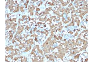 Formalin-fixed, paraffin-embedded human Pituitary stained with Growth Hormone Recombinant Mouse Monoclonal Antibody (rGH/1450). (Recombinant Growth Hormone 1 antibody  (AA 58-187))