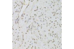 Immunohistochemistry of paraffin-embedded human leiomyoma of uterus using RUVBL1 Antibody. (RUVBL1 antibody  (AA 1-240))