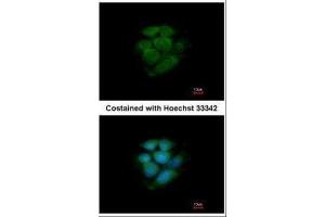 ICC/IF Image Immunofluorescence analysis of methanol-fixed MCF-7, using JNK2, antibody at 1:200 dilution. (JNK2 antibody)