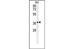 Western blot analysis of LGALS9B Antibody (Center) in 293 cell line lysates (35ug/lane).