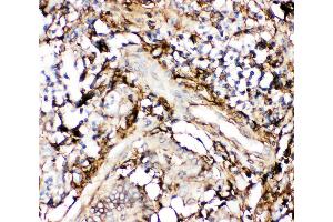 Immunohistochemistry (IHC) image for anti-Annexin A5 (ANXA5) (AA 2-320) antibody (ABIN3043502)