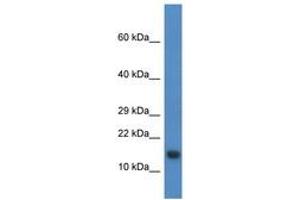 Image no. 1 for anti-Proline Rich Nuclear Receptor Coactivator 2 (PNRC2) (N-Term) antibody (ABIN6746484) (PNRC2 antibody  (N-Term))