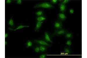 Immunofluorescence of monoclonal antibody to AKR1B10 on HeLa cell. (AKR1B10 antibody  (AA 76-143))