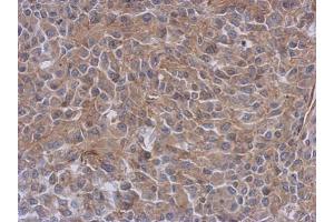 IHC-P Image Immunohistochemical analysis of paraffin-embedded RT2 xenograft, using Radixin, antibody at 1:500 dilution. (Radixin antibody)