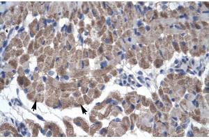Rabbit Anti-GAS7 Antibody Catalog Number: ARP30004 Paraffin Embedded Tissue: Human Muscle Cellular Data: Skeletal muscle cells Antibody Concentration: 4. (GAS7 antibody  (N-Term))