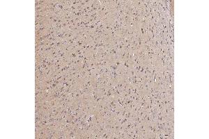 IHC analysis of Septin 11/SEPTIN11 using anti-Septin 11/SEPTIN11 antibody (ABIN7602925). (Septin 11 antibody  (C-Term))