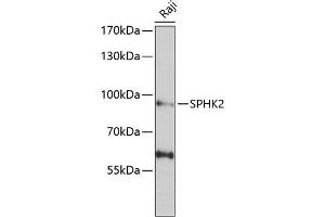 Western blot analysis of extracts of Raji cells, using SPHK2 antibody (ABIN6128746, ABIN6148347, ABIN6148348 and ABIN6222478) at 1:1000 dilution. (SPHK2 antibody  (AA 1-165))