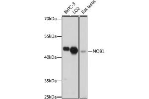 Western blot analysis of extracts of various cell lines, using NOB1 antibody (ABIN7270109) at 1:1000 dilution. (NOB1 antibody  (AA 1-230))
