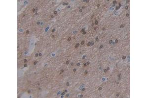 Used in DAB staining on fromalin fixed paraffin- embedded Kidney tissue (ARNT2 antibody  (AA 1-209))