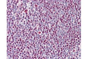 Anti-IKZF3 / AIOLOS antibody IHC of human tonsil. (IKZF3 antibody  (N-Term))