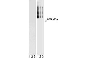 Western Blot analysis of TRA-1-60 in mouse and human ES cell lines. (TRA1-81 antibody)
