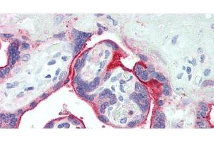 Immunohistochemistry (Paraffin-embedded Sections) (IHC (p)) image for anti-Poliovirus Receptor-Related 4 (PVRL4) antibody (ABIN7237516)