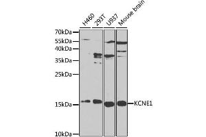 Western blot analysis of extracts of various cell lines, using KCNE1 antibody (ABIN1873374) at 1:1000 dilution. (KCNE1 antibody)