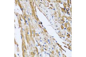 Immunohistochemistry of paraffin-embedded rat heart using GOLM1 antibody (ABIN5974385) at dilution of 1/100 (40x lens). (GOLM1 antibody)