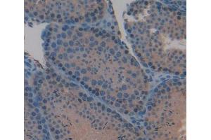 #VALUE! (IL-3 antibody  (AA 33-166))