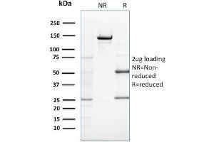 SDS-PAGE Analysis Purified ZNF690 / ZSCAN29 Mouse Monoclonal Antibody (ZSCAN29/2610).