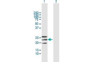 Western Blot analysis of EFNA2 expression in transfected 293T cell line by EFNA2 MaxPab polyclonal antibody. (Ephrin A2 antibody  (AA 1-213))