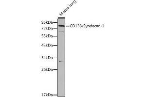 Western blot analysis of extracts of Mouse lung cells, using CD138/Syndecan-1 antibody (ABIN3021804, ABIN3021805, ABIN3021806 and ABIN6215950) at 1:1000 dilution.