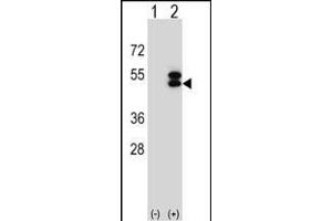 Western blot analysis of ATXN3 (arrow) using rabbit polyclonal ATXN3 Antibody (Center) (ABIN653191 and ABIN2842741).