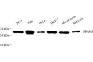 Western blot analysis of SPAM1 (ABIN7075699),at dilution of 1: 600 (SPAM1 antibody)