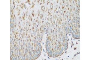 Immunohistochemistry of paraffin-embedded Human esophagus using IGF2BP3 Polyclonal Antibody at dilution of 1:200 (40x lens). (IGF2BP3 antibody)