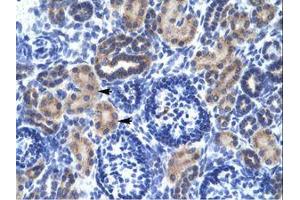 Image no. 3 for anti-Ring Finger Protein 141 (RNF141) (AA 96-145) antibody (ABIN6735889) (RNF141 antibody  (AA 96-145))