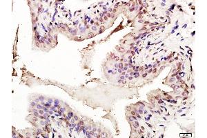 Paraformaldehyde-fixed, paraffin embedded rat bladder tissue, Antigen retrieval by boiling in sodium citrate buffer(pH6) for 15min, Block endogenous peroxidase by 3% hydrogen peroxide for 30 minutes, Blocking buffer (normal goat serum) at 37°C for 20min, Antibody incubation with Rabbit Anti-p53 (FL-393) Polyclonal Antibody, Unconjugated  at 1:400 overnight at 4°C, followed by a conjugated secondary and DAB staining (p53 antibody  (AA 1-393))