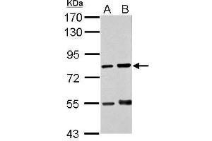 WB Image Sample (30 ug of whole cell lysate) A: THP-1 B: HL-60 7. (Protein Red (IK) (N-Term) antibody)